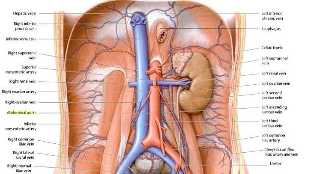 Ectatic thoracic aorta