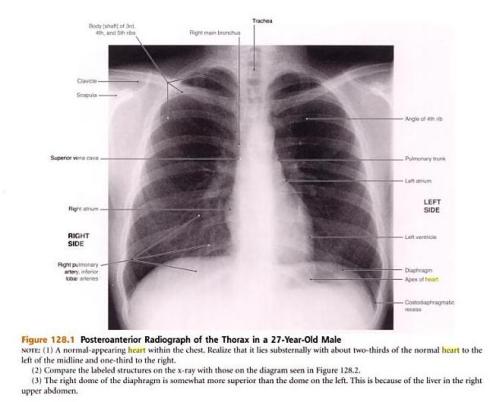 X ray of Heart - need to know 4 test